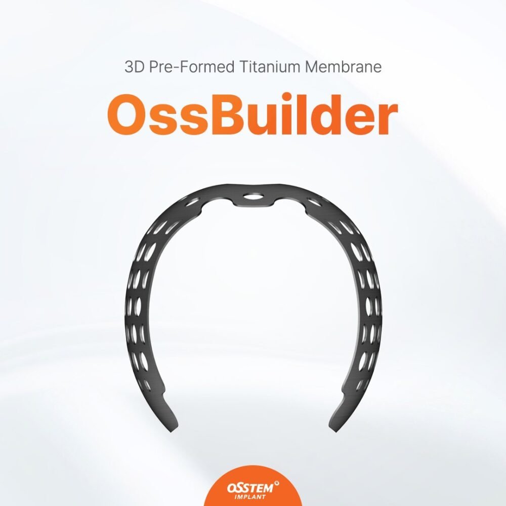 Smart Builder OSSTEM